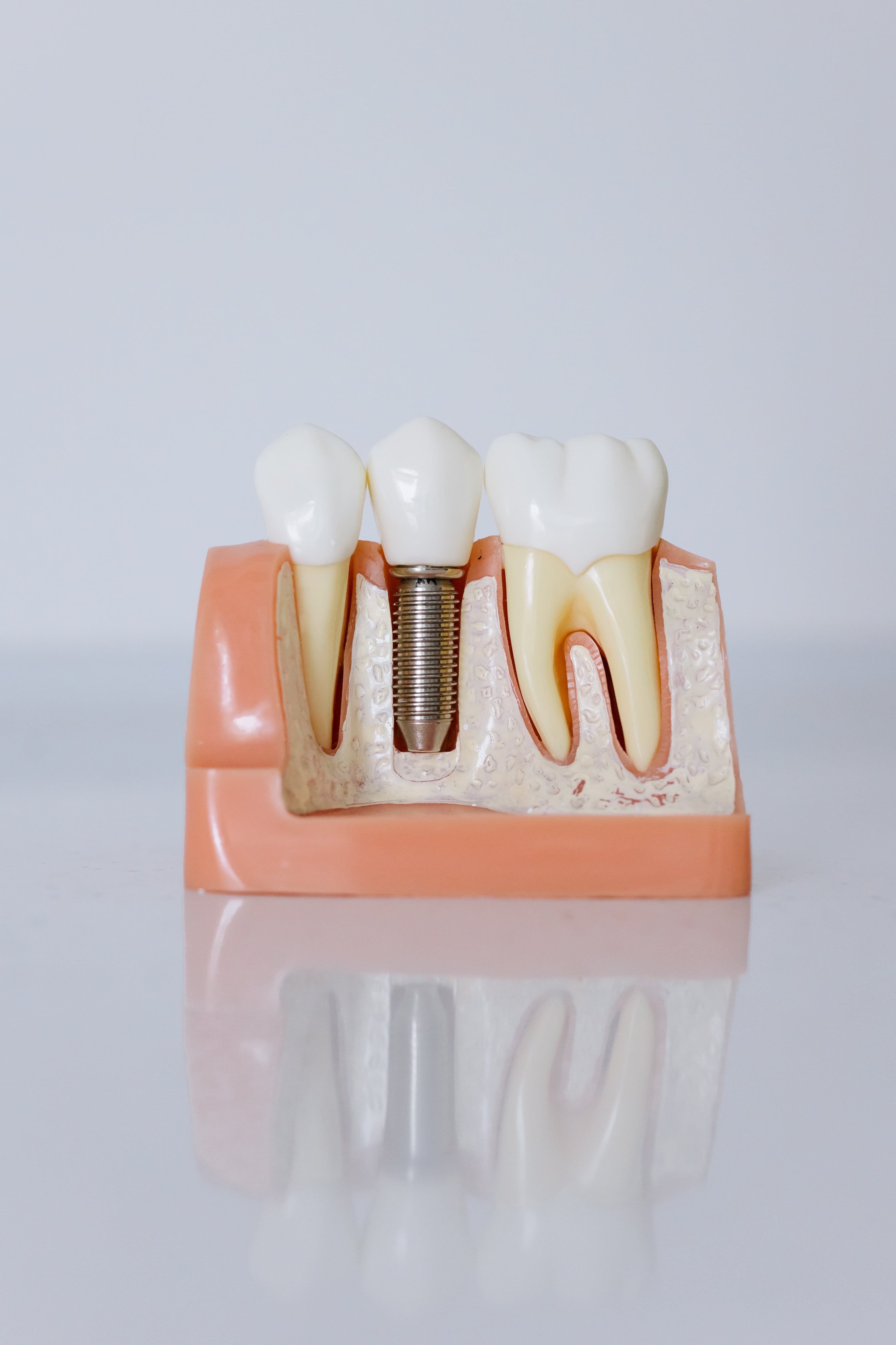 Implantologie image 3