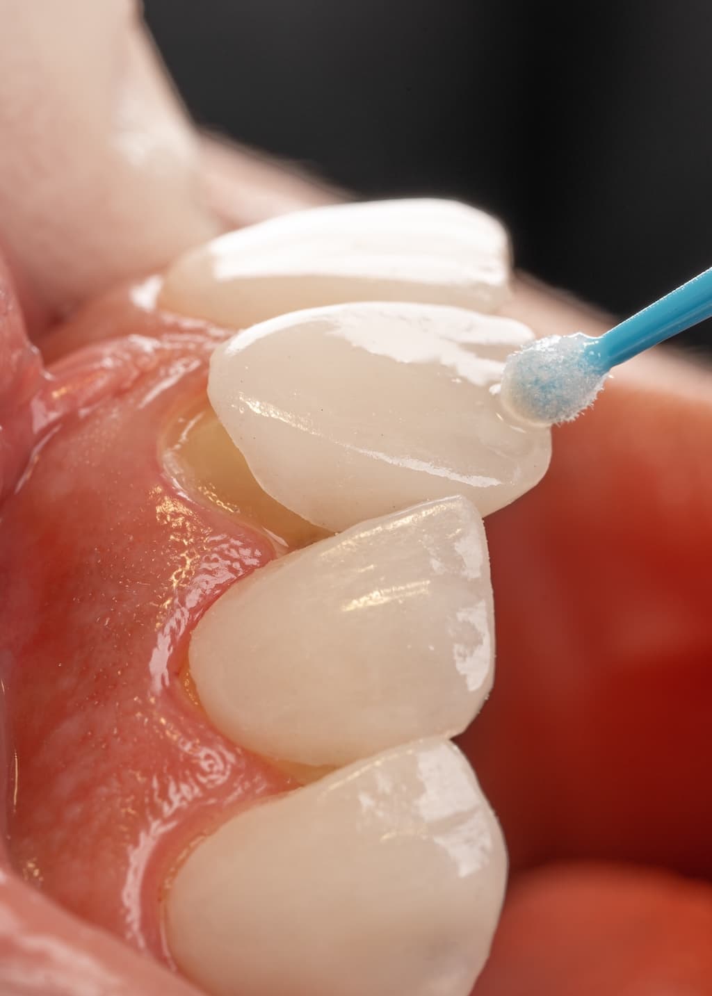 Estetică și Protetică Dentară