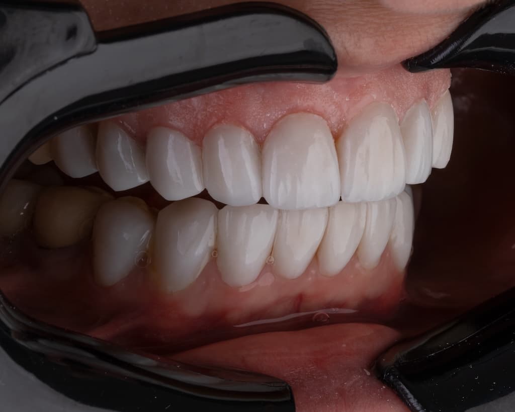 Estetică și Protetică Dentară image 1
