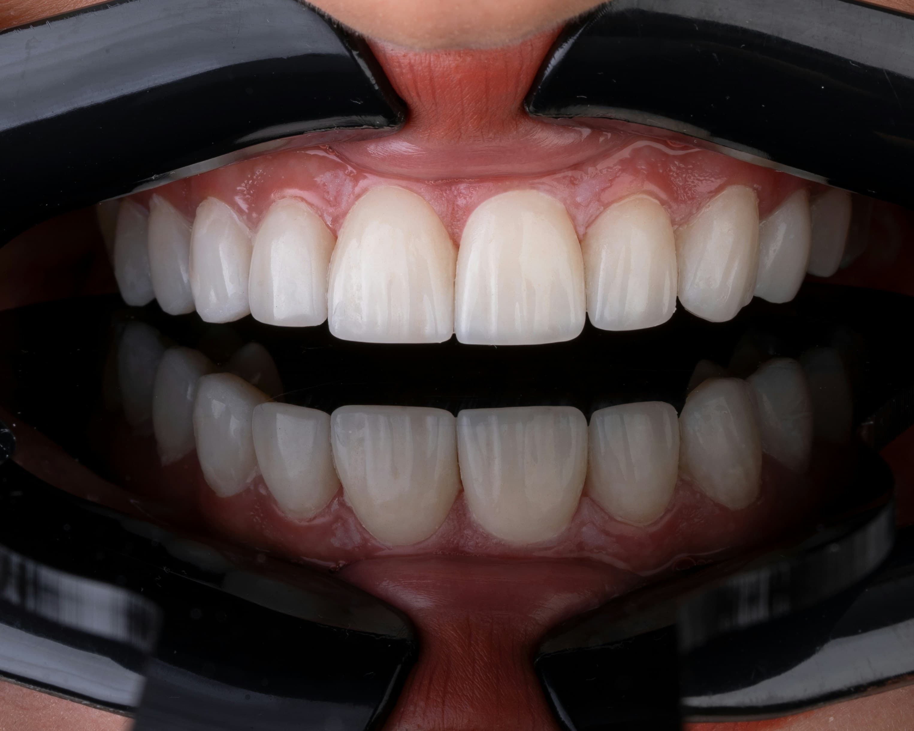 Estetică și Protetică Dentară image 2