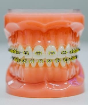 Ortodonție gallery image