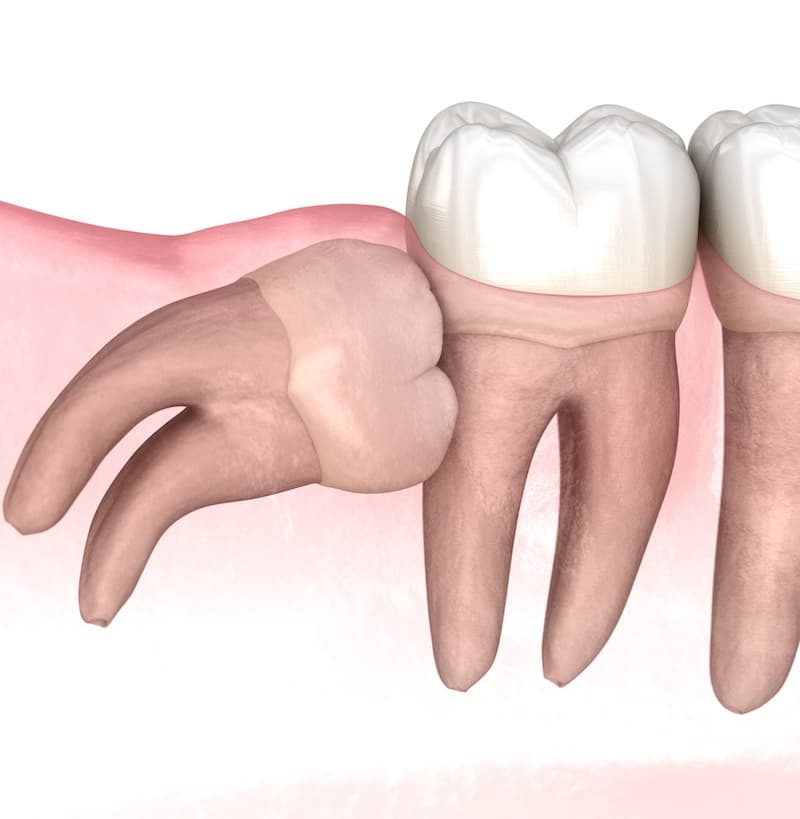 Chirurgie Dentară image 2
