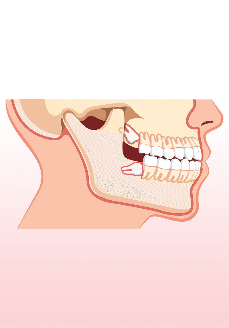 Chirurgie Dentară image 1